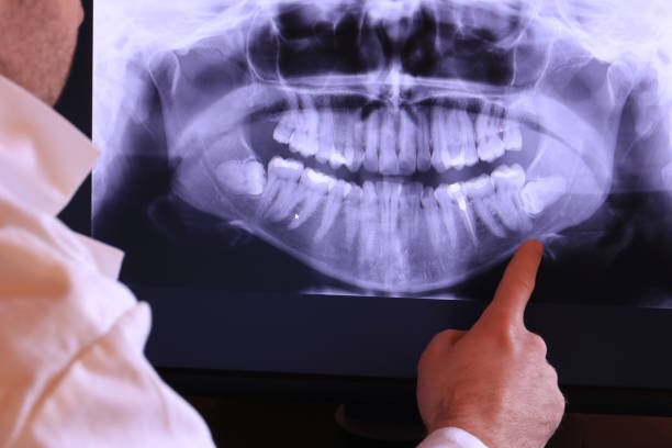Best Emergency Dental Services for Seniors in Barrett, TX